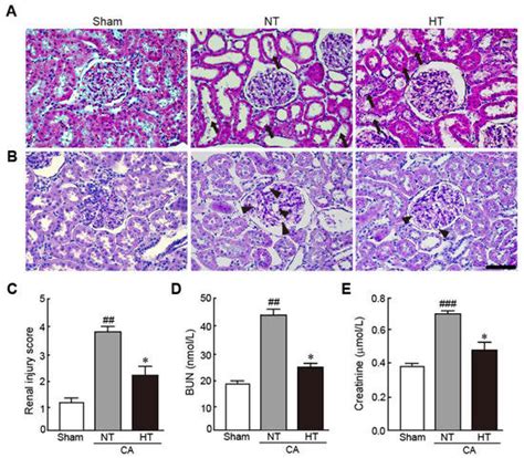 Olanzapine-Induced Therapeutic Hypothermia Attenuates Renal Injury in ...