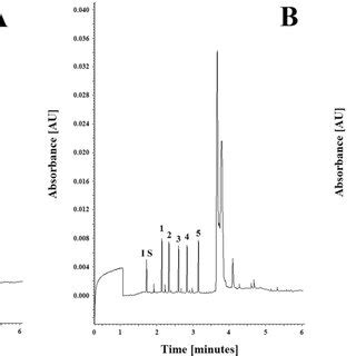 Image result for Electropherogram vs Chromatogram