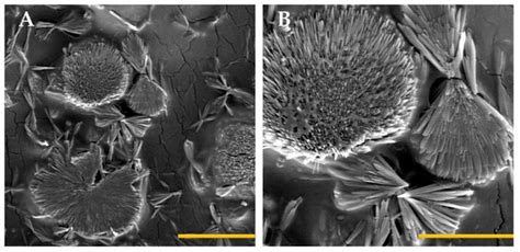 Gels | Special Issue : Physically Cross-Linked Gels and Their Applications