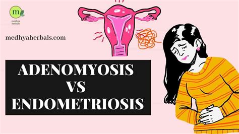 adenomyosis vs endometriosis