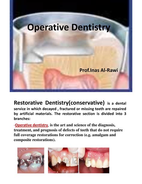 Image result for Operative Dentistry