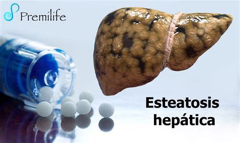 Hígado Graso | Premilife - Homeopathic Remedies