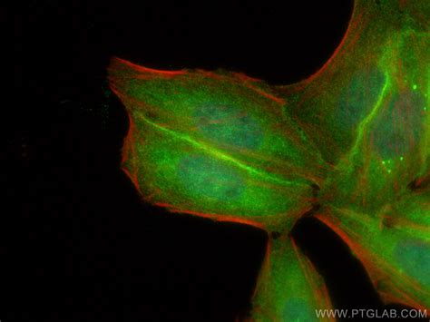 HDAC5 antibody (29342-1-AP) | Proteintech