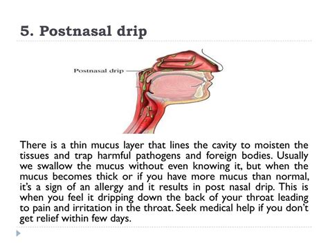 PPT - 5 Nasal Allergy Symptoms You Should Not Ignore PowerPoint Presentation - ID:7441562