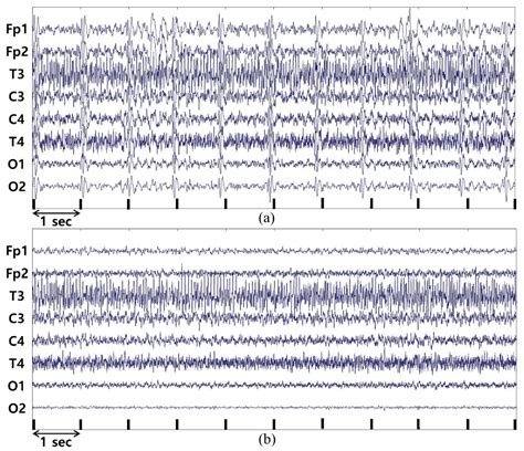 Comparison between Concentration and Immersion Based on EEG Analysis