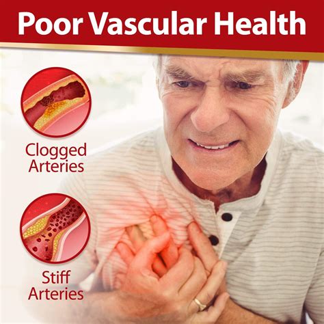 Buy LABO Nutrition VesseCLEAR EX: Nattokinase NSK-SD+Elastin F for ...