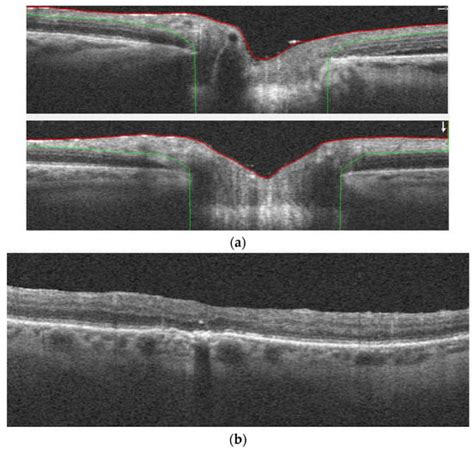 Emulsification of Silicone Oils: Altering Factors and Possible ...