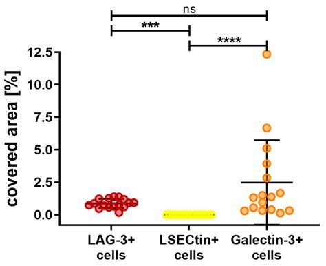 Characterization and Quantitation of the Tumor Microenvironment of ...