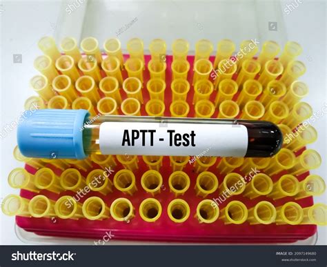 816 Blood Coagulation Patient Images, Stock Photos & Vectors | Shutterstock