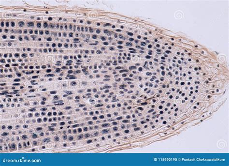 Anaphase Of Mitotic Onion Root Tip Cells Under The Microscope Royalty ...