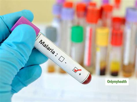 Monkey Malaria: Causes, Symptoms, Prevention and Treatment | OnlyMyHealth