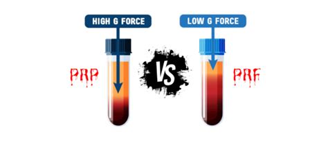 Image result for PRF Testing