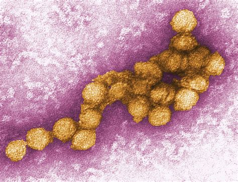 Transmission electron microscope (TEM) | Britannica