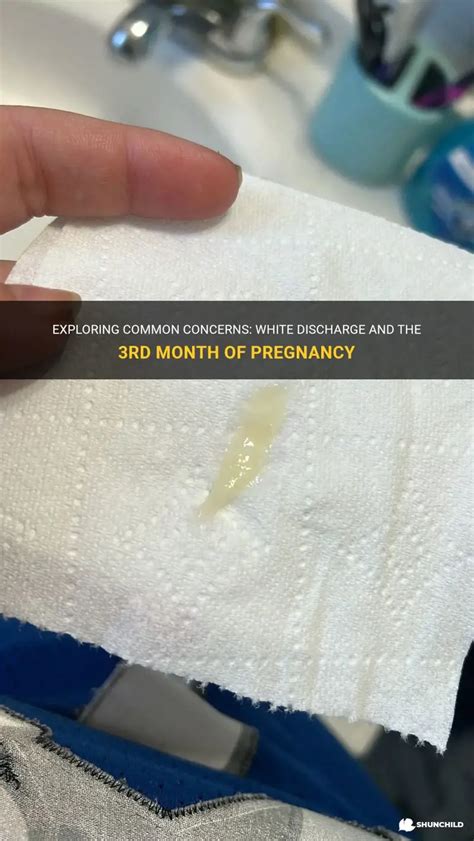 Exploring Common Concerns: White Discharge And The 3Rd Month Of ...