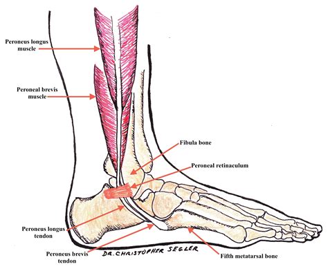 Peroneus Longus Muscle Pain