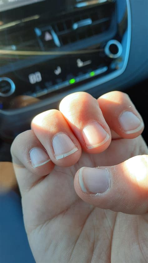 How to Fix Split Nails 的图像结果