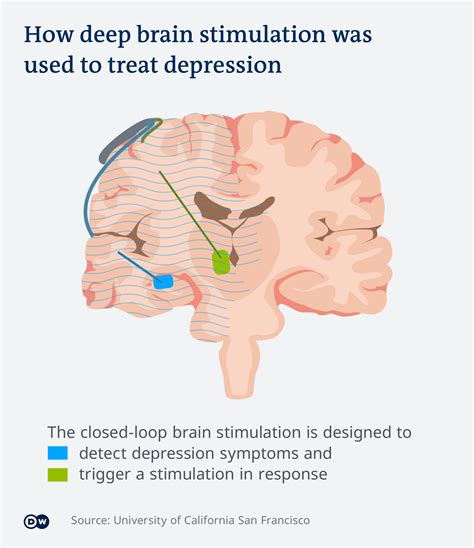 When Its Depressed Brain
