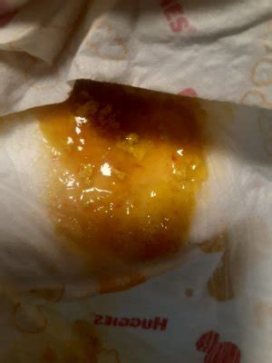 Sangue nas fezes | BabyCenter