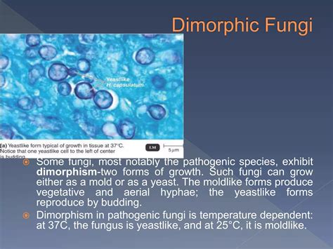 morphology & structure of spirochete, fungi & protozoa | PPT