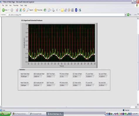 Image result for Remote Neural Monitoring Panel