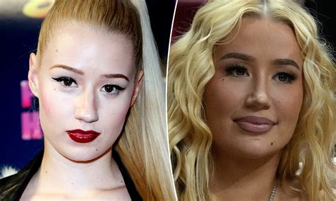 Iggy Azalea Before And After