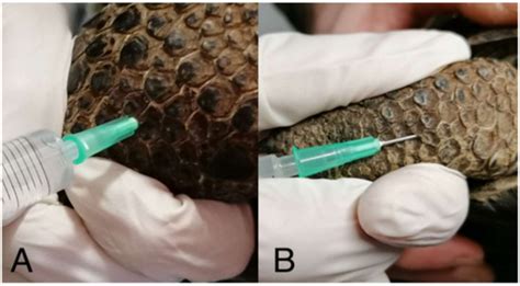 Comparison of Subcutaneous versus Intramuscular Dexmedetomidine ...