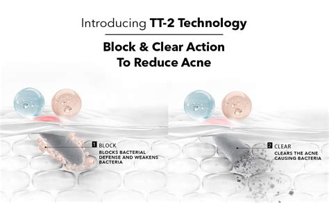 Novology Acne Reduction Serum | Face Serum for Acne, Whiteheads ...