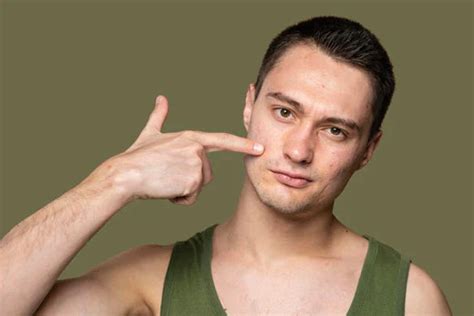 Home Remedies for Pigmentation: How to Remove Dark Spots – mars by GHC