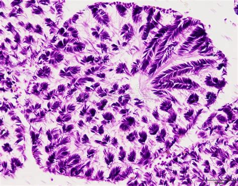 Image result for Tissue Sample Drawing Under Microscope