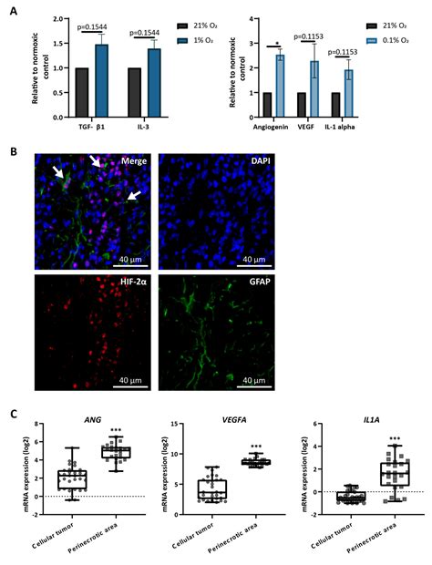 Hypoxia-Induced Reactivity of Tumor-Associated Astrocytes Affects ...