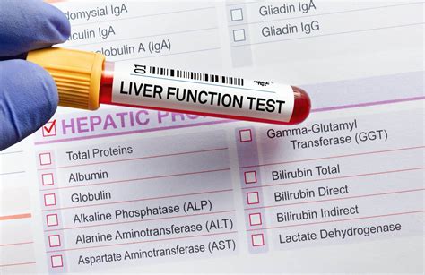 Image result for Liver Function Labs