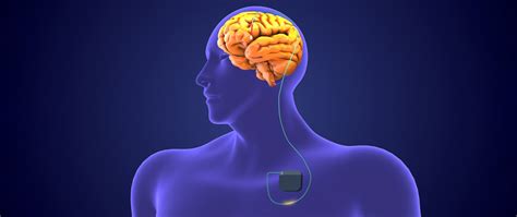 Neurological Disorders: Causes, Symptoms, and Treatment - IBS Hospital