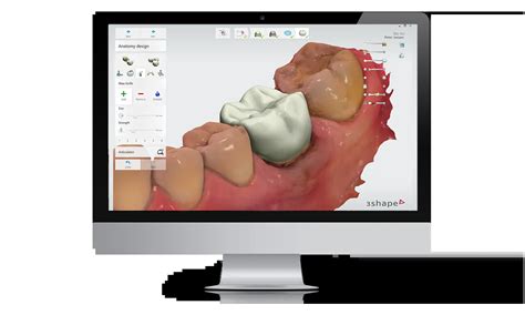3Shape Design Studio 的图像结果