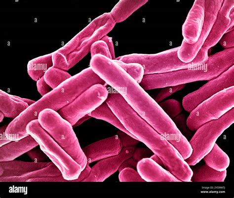 Scanning electron micrograph of Mycobacterium tuberculosis particles colorized pink, the ...