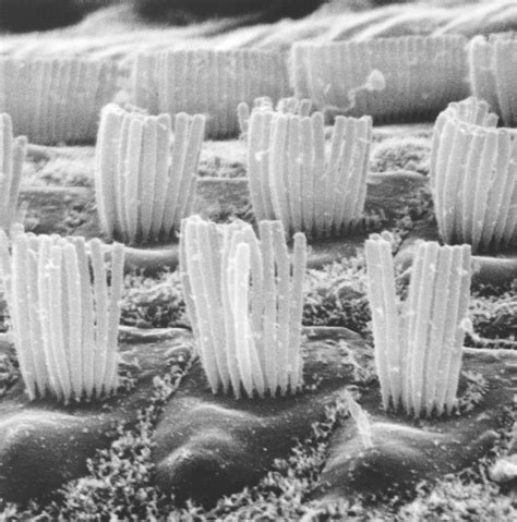 Electron Microscopy Cell 的图像结果