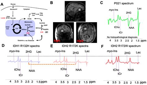 A Noninvasive Comparison Study between Human Gliomas with IDH1 and IDH2 ...