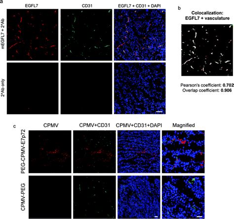 Image result for ImageJ Colocalization Coloc