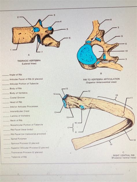 Answered: 15 10 THORACIC VERTEBRA (Lateral View) Angle of Rib RIB TO ...