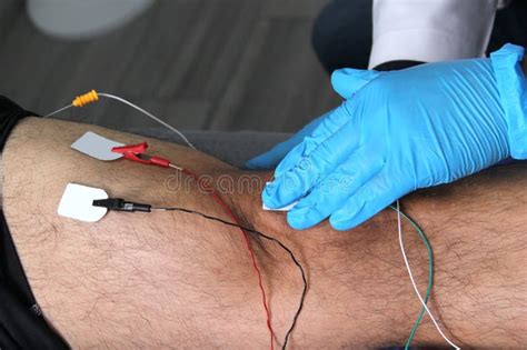 Image result for Lower Extremity EMG Testing