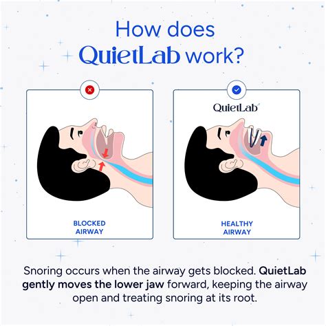Does Quietlab Work