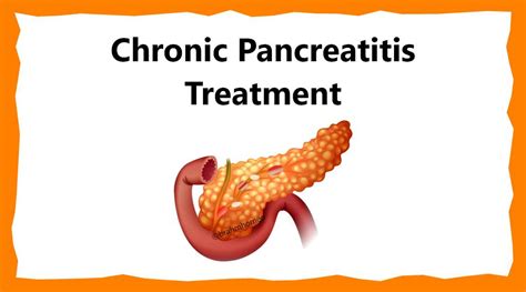 Chronic Pancreatitis Treatment | Chronic Pancreatitis