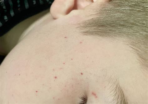 Everything feels much thicker than it is in my hands : r/DiagnoseMe