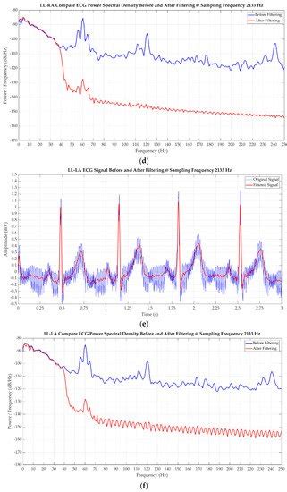 Design of a Solar-Powered Portable ECG Device with Optimal Power ...
