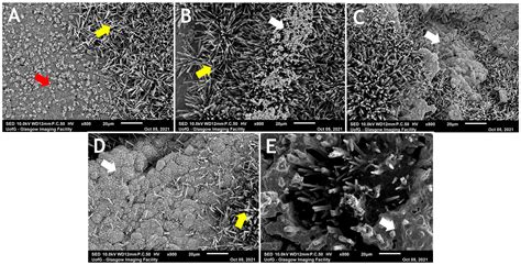 The Effect of Chitosan Incorporation on Physico-Mechanical and ...