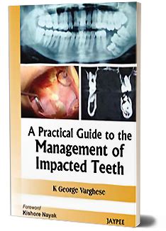 JaypeeDigital | Other Methods for Removal of Impacted Lower Third Molar