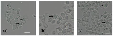 Genome Analysis of a Newly Discovered Yeast Species, Hanseniaspora menglaensis