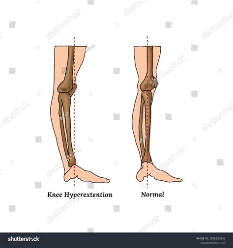 מעורב הופס ליום השנה האזרחית / מנחם לס – Hoops