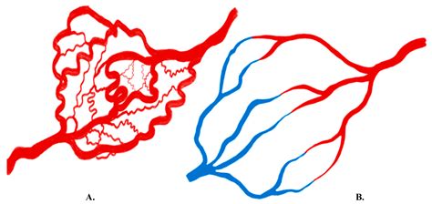 Current Concepts in Multi-Modality Imaging of Solid Tumor Angiogenesis