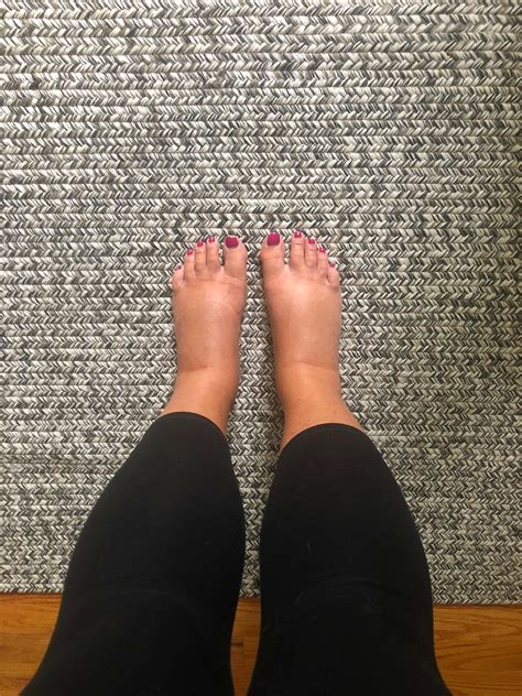 swollen pregnancy feet • Foodie Loves Fitness