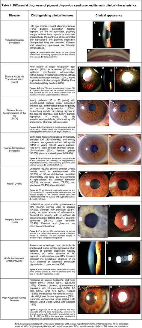 Pigment dispersion syndrome and its implications for glaucoma - Survey ...